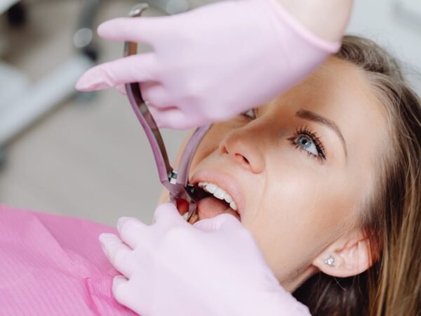 i want to make my teeth white